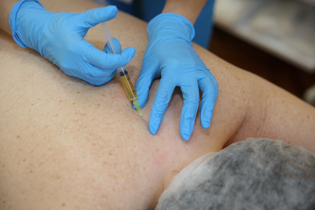 Injektiounen vu Chondroprotectors fir de Réck