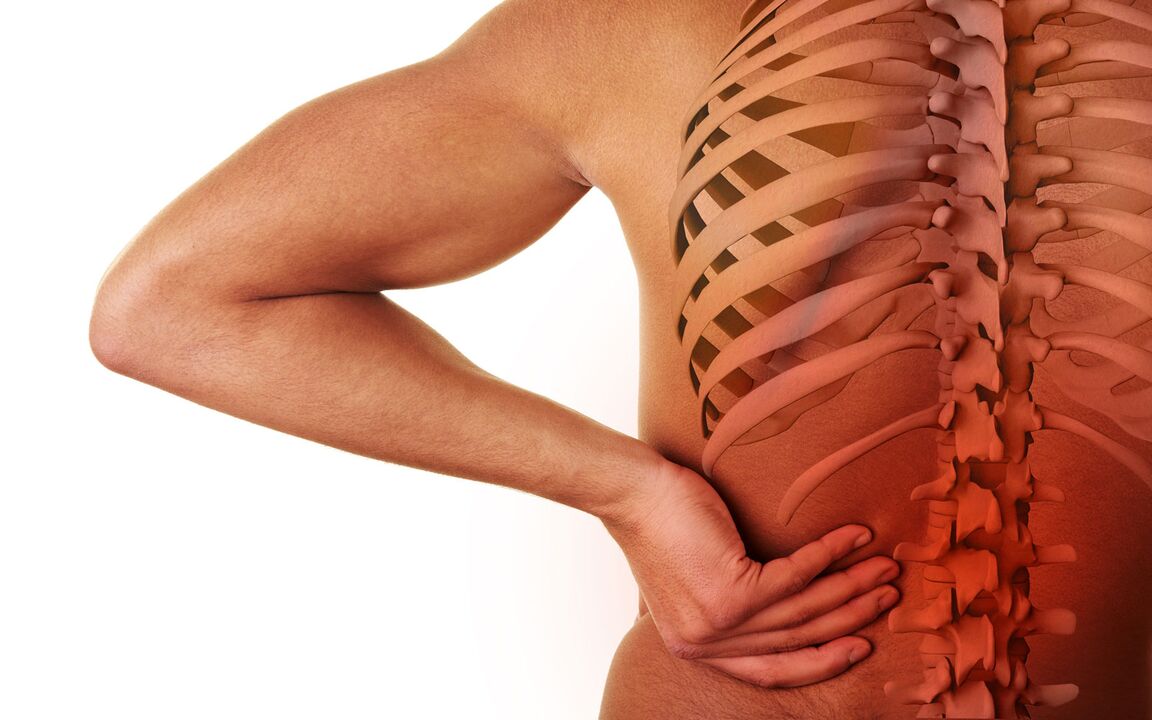 Symptomer vun der Lendeger Osteochondrose